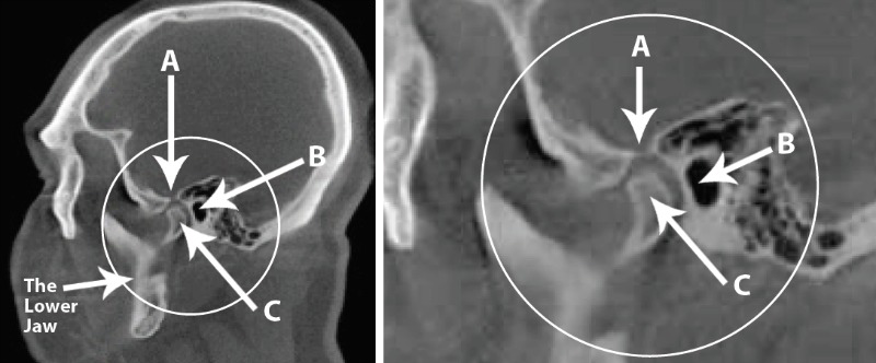 jaw joint circle